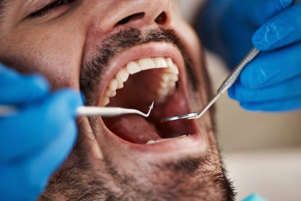 Best Pediatric Emergency Dentist in New Franklin, MO